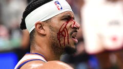 New York Knicks guard Josh Hart (3) is bloodied after taking an elbow to the eye in the first half during game five of the second round for the 2025 NBA Playoffs against the Boston Celtics at TD Garden. 